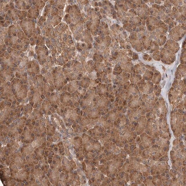 Anti-RWDD1 antibody produced in rabbit
