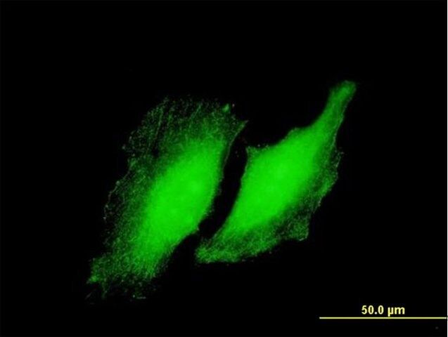 Anti-RYBP antibody produced in mouse