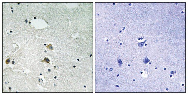 Anti-S6 Ribosomal Protein antibody produced in rabbit