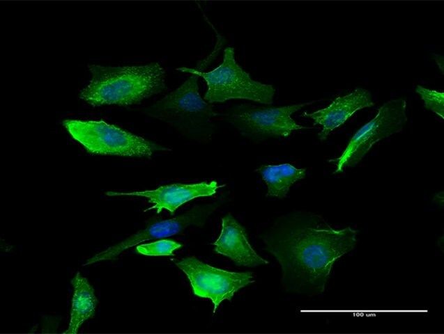 Anti-S100A10 antibody produced in mouse