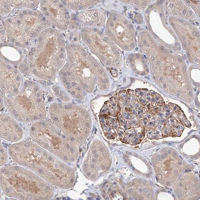 Anti-RWDD4 antibody produced in rabbit