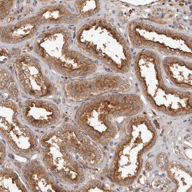 Anti-RWDD1 antibody produced in rabbit