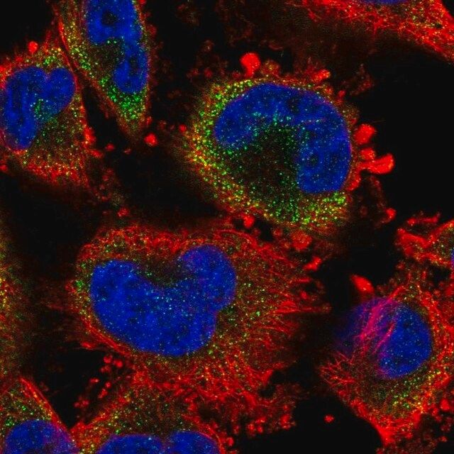 Anti-S100A3 antibody produced in rabbit