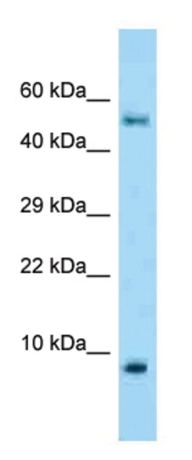 Anti-S100A10 antibody produced in rabbit