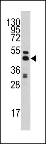 ANTI-S ADENOSYLHOMOCYSTEINE HYDROLASE (ACHY)(C-TERMINAL) antibody produced in rabbit