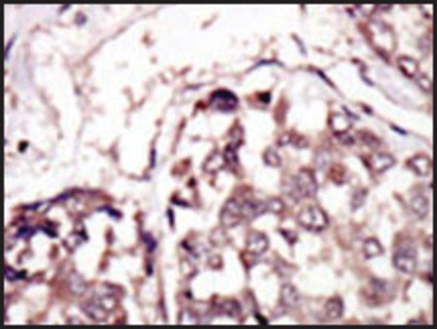 Anti-RYK (C-term) antibody produced in rabbit