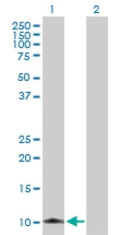 Anti-S100A8 antibody produced in rabbit