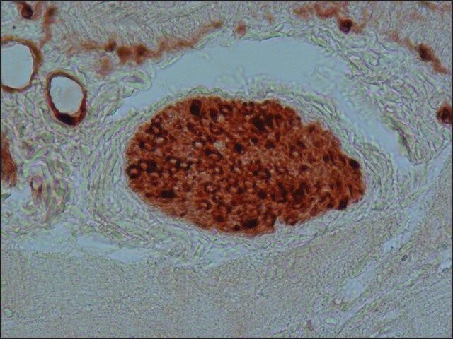Anti-S-100 (β-Subunit) antibody, Mouse monoclonal