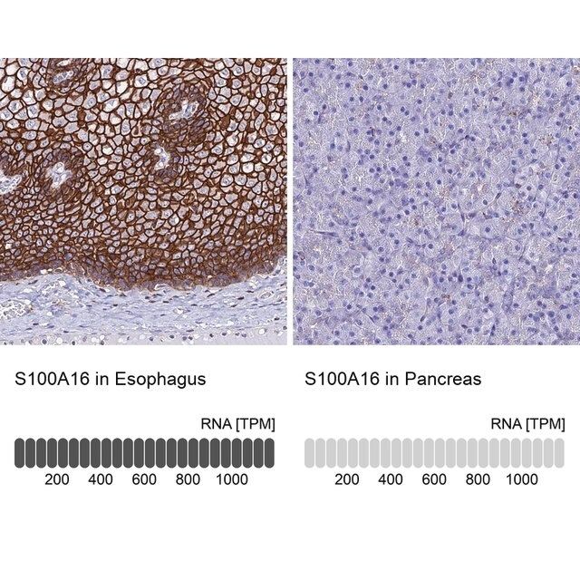 Anti-S100A16 antibody produced in rabbit