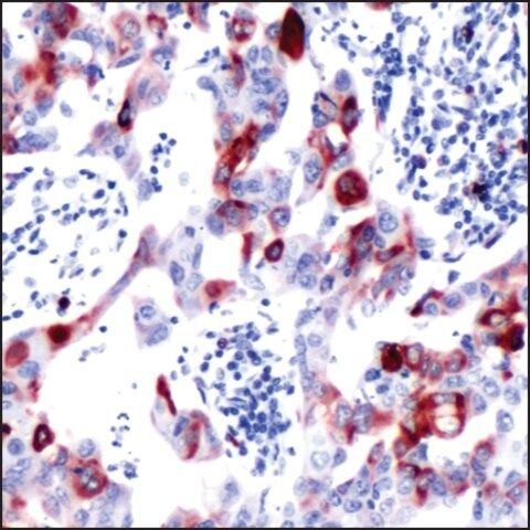 Anti-S6 Ribosomal Protein (phospho S240/244) antibody, Rabbit monoclonal