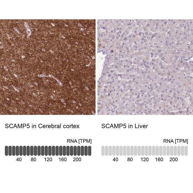 Anti-SCAMP5 antibody produced in rabbit