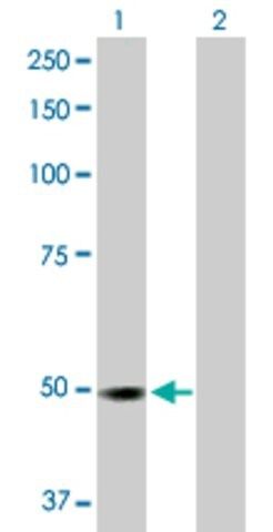 Anti-RP6-213H19.1 antibody produced in rabbit