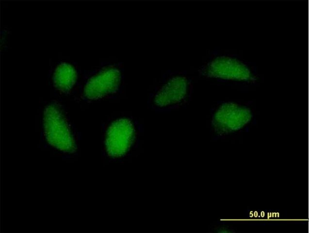 Anti-RPE antibody produced in mouse