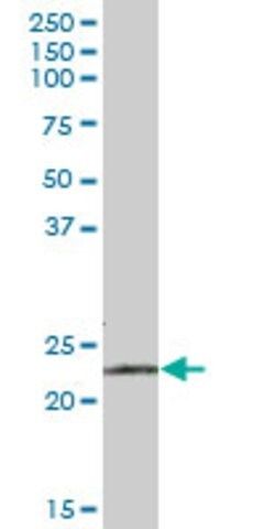 Anti-RPE antibody produced in mouse