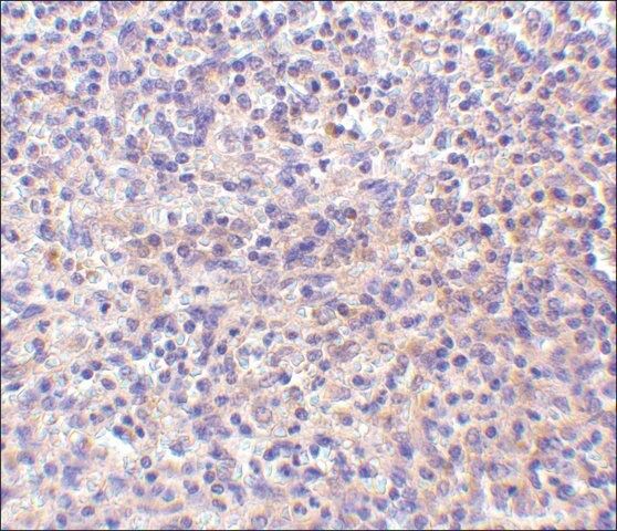 Anti-RP105 antibody produced in rabbit