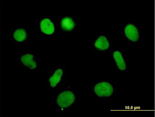 Anti-RPA3 antibody produced in mouse