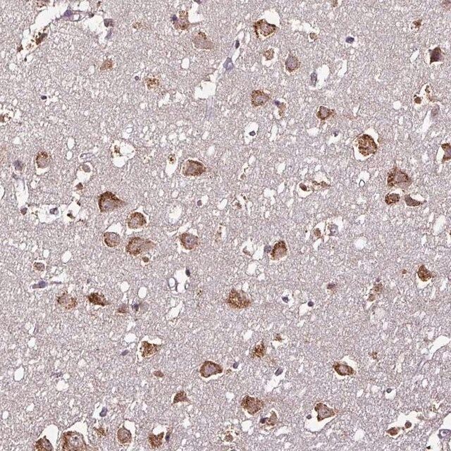 Anti-RPL38 antibody produced in rabbit