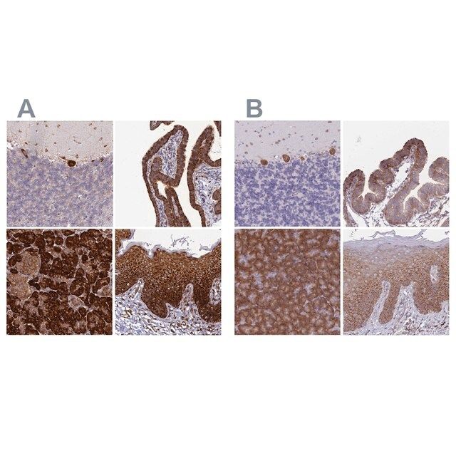 Anti-RPL8 antibody produced in rabbit