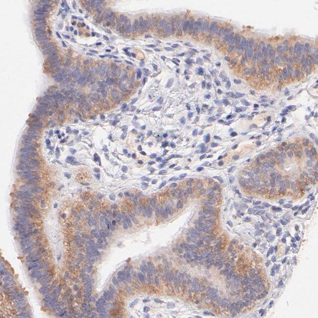 Anti-RPL11 antibody produced in rabbit