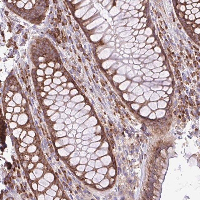 Anti-RPL7 antibody produced in rabbit
