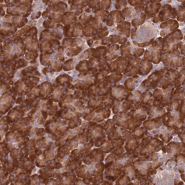 Anti-RPL17 antibody produced in rabbit