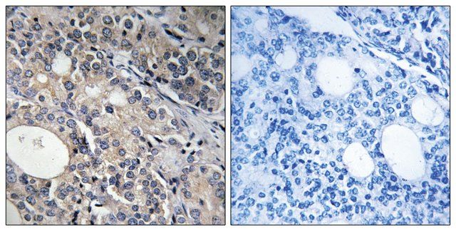 Anti-RPL17 antibody produced in rabbit