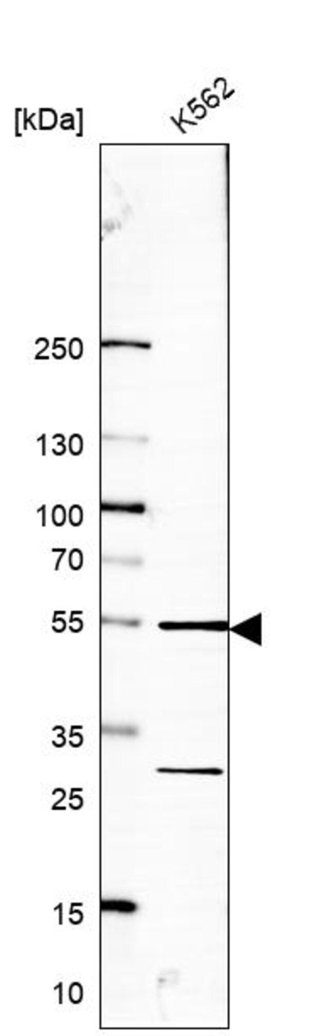 Anti-RRP1 antibody produced in rabbit