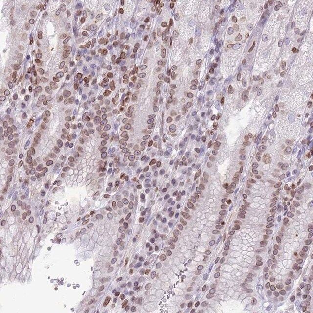 Anti-RRNAD1 antibody produced in rabbit