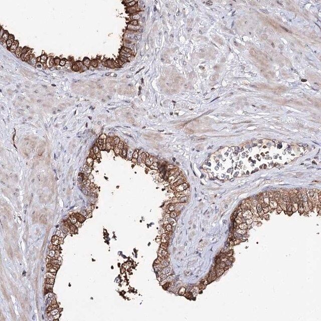 Anti-RRP9 antibody produced in rabbit