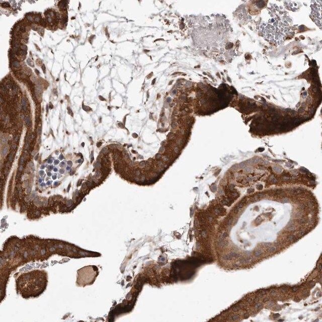 Anti-RRM2B antibody produced in rabbit