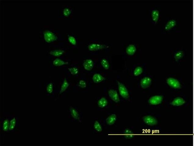 Anti-RRP1 antibody produced in mouse