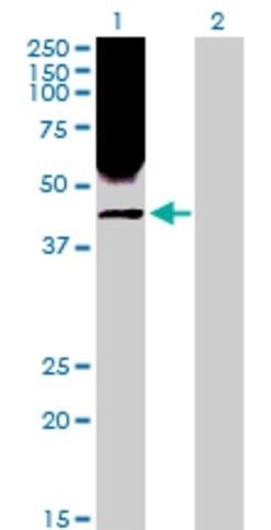 Anti-RRM2 antibody produced in rabbit