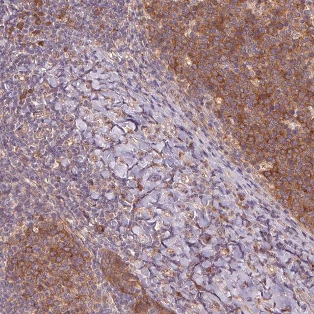 Anti-RRM1 antibody produced in rabbit