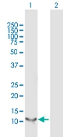 Anti-RBP5 antibody produced in mouse