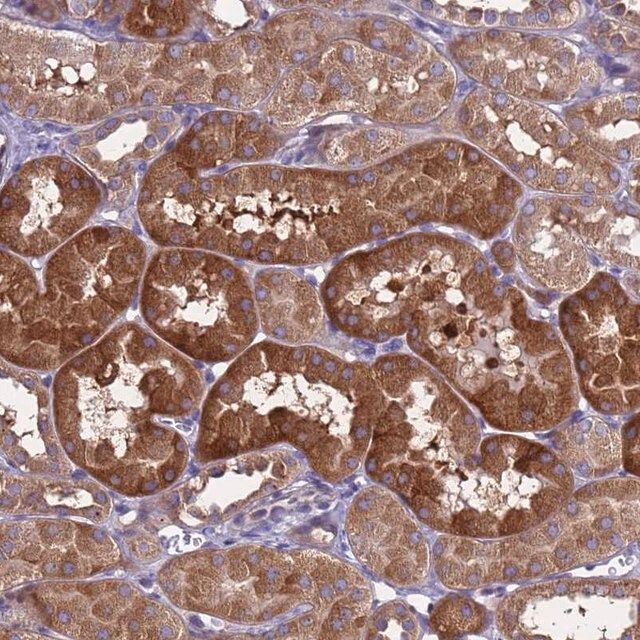 Anti-RC3H2 antibody produced in rabbit