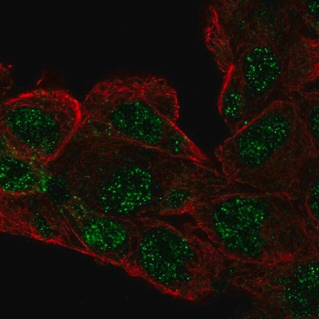 Anti-RCBTB1 antibody produced in rabbit