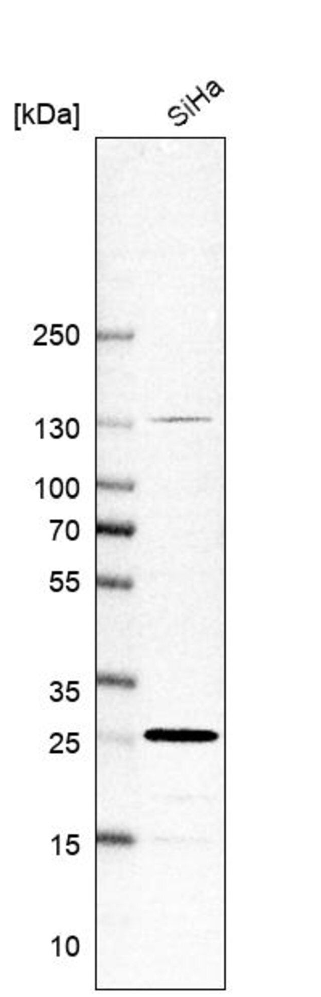 Anti-RAB21 antibody produced in rabbit
