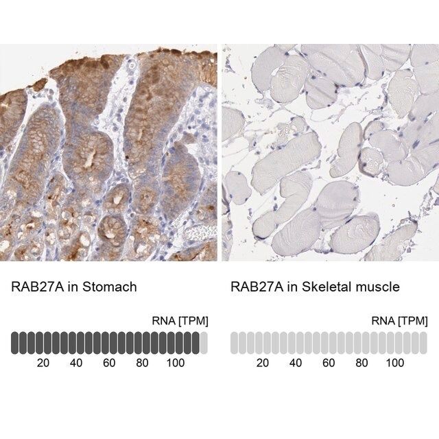 Anti-RAB27A antibody produced in rabbit
