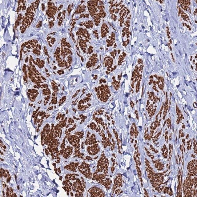 Anti-RAB39A antibody produced in rabbit