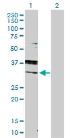 Anti-RAB7A antibody produced in rabbit