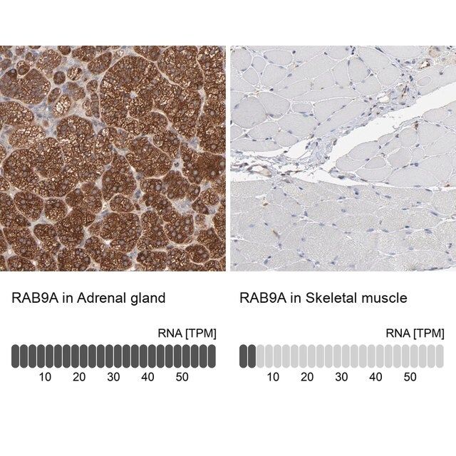 Anti-RAB9A antibody produced in rabbit