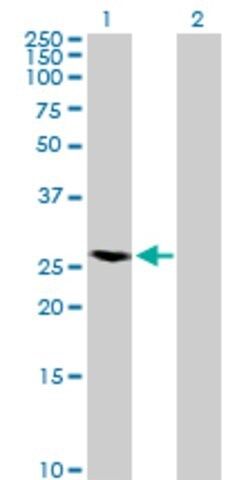 Anti-RAB40A antibody produced in mouse