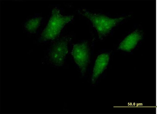 Anti-RBED1 antibody produced in mouse