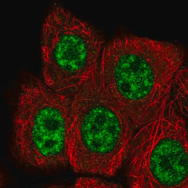 Anti-RBBP6 antibody produced in rabbit