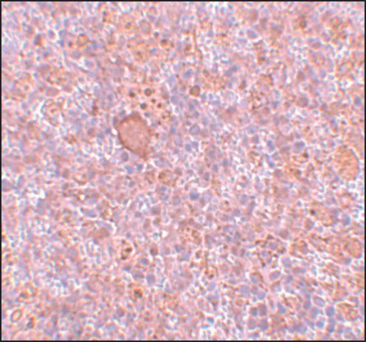 Anti-RBBP8 antibody produced in rabbit