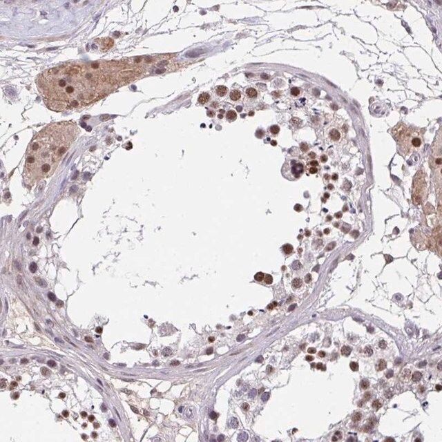 Anti-RBBP6 antibody produced in rabbit