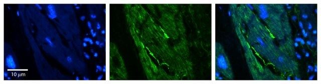 Anti-RB1CC1 antibody produced in rabbit