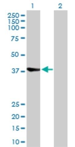 Anti-RBCK1 antibody produced in rabbit