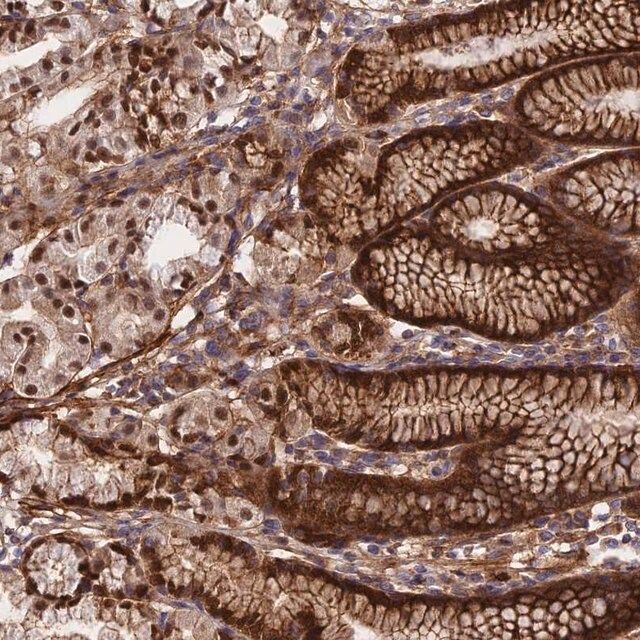 Anti-RBBP8NL antibody produced in rabbit