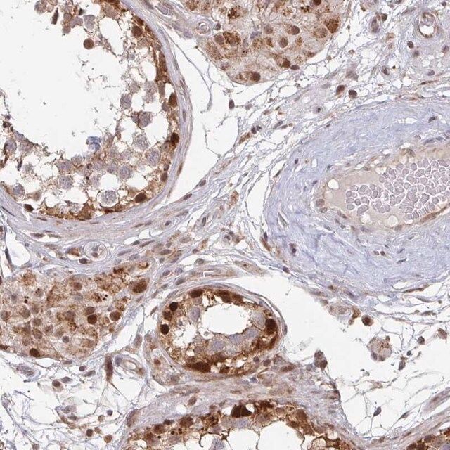 Anti-RBBP5 antibody produced in rabbit